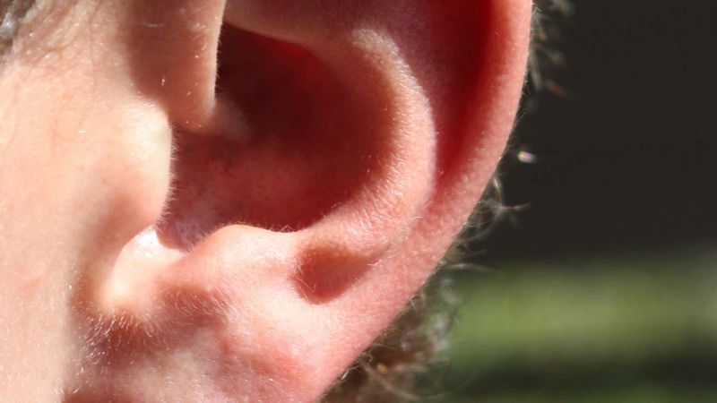 Tener vaginas en lugar de orejas o penes en lugar de dedos