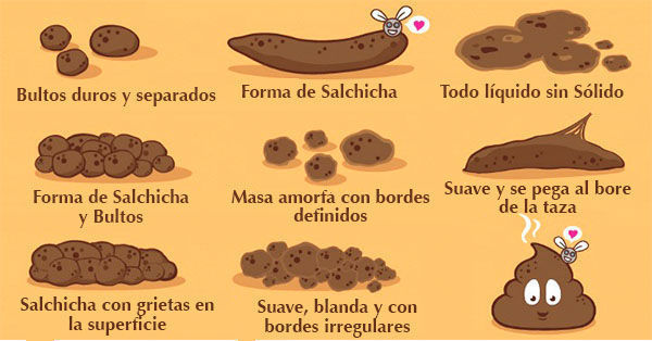 ¿Cómo suele ser tu caca? (ya sé que esta es asquerosilla) FÍJATE EN LA IMAGEN