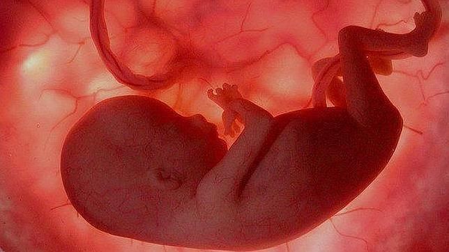 ¿Que opinas sobre el aborto?